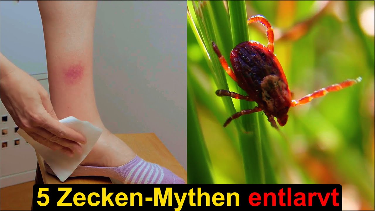Zecken-Mythen entlarvt
