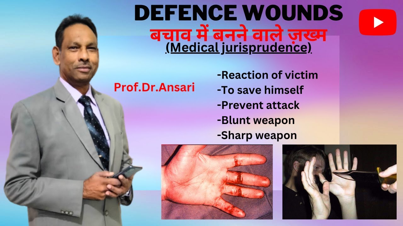 Defence wound | Prevent attack | Blunt weapon | Sharp weapon | Reaction of victim
