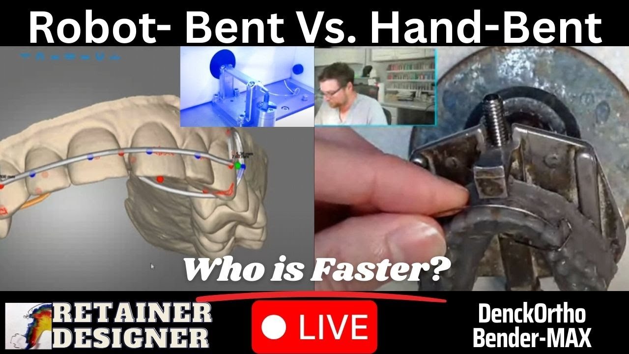 Robot-Bent vs Hand-Bent: Hawley with C Clasps