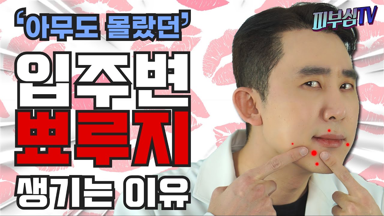 아무도 몰랐던, 입주변 뾰루지가 생기는 이유! [피부과전문의 피부심]