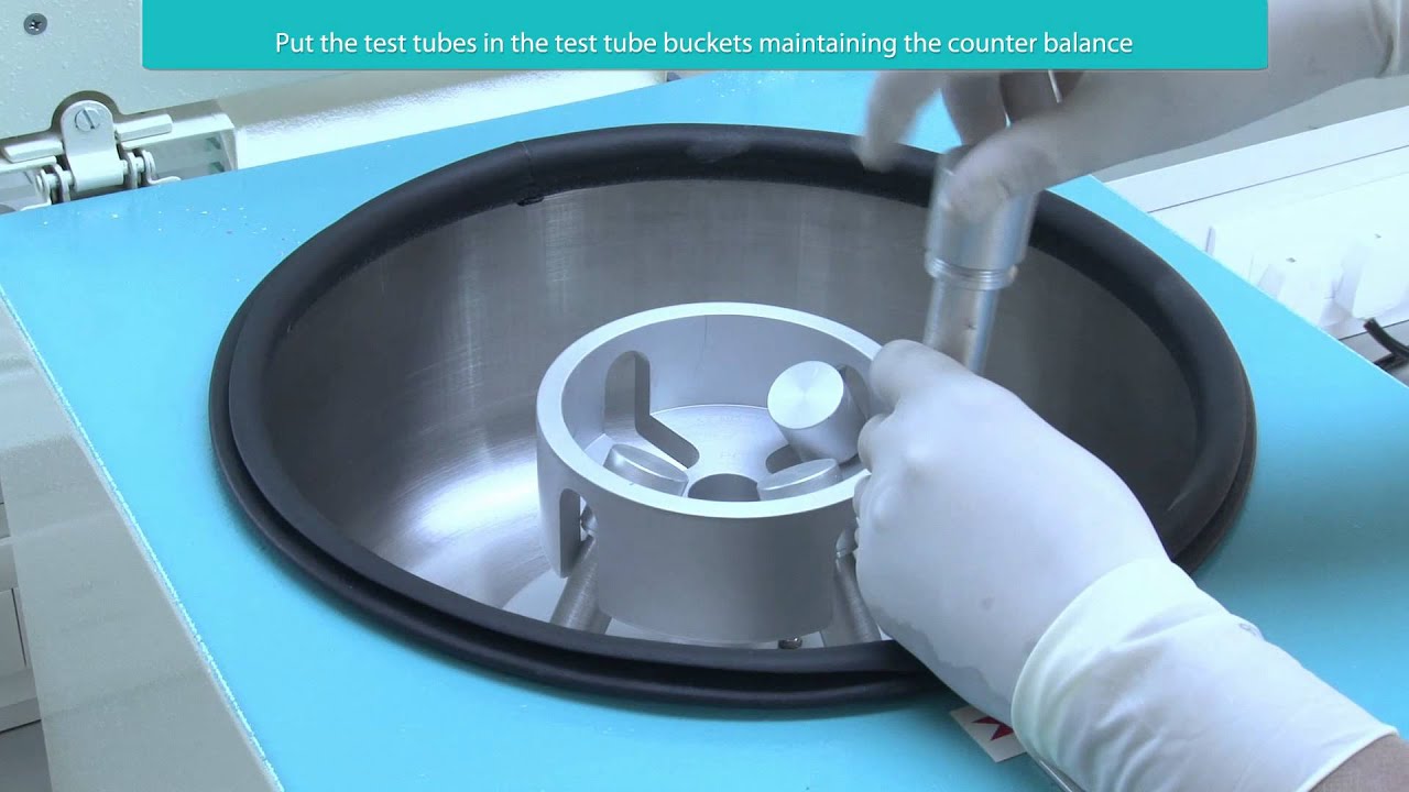 Andro Spin - Sperm Separation System by Sperm360