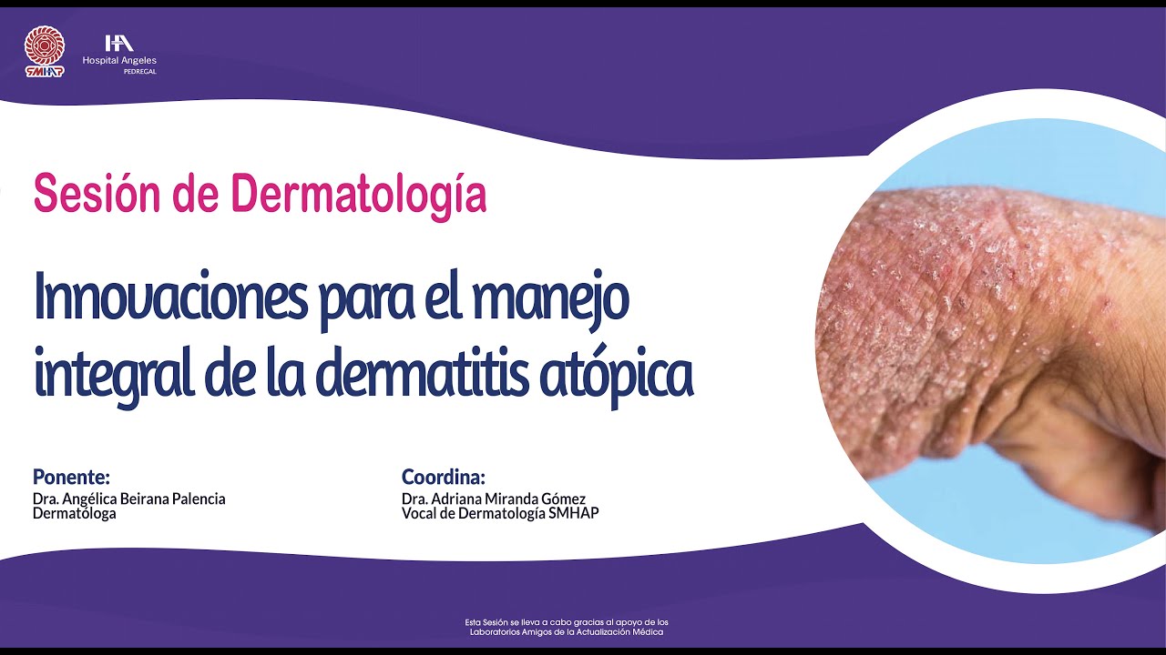 Innovaciones para el manejo integral de la dermatitis atópica