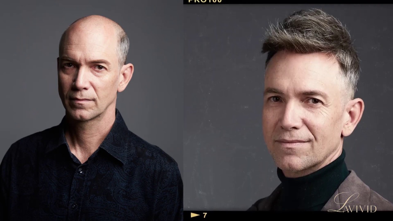 Lavivid Best Non-Surgical Hair Loss Solution for Men