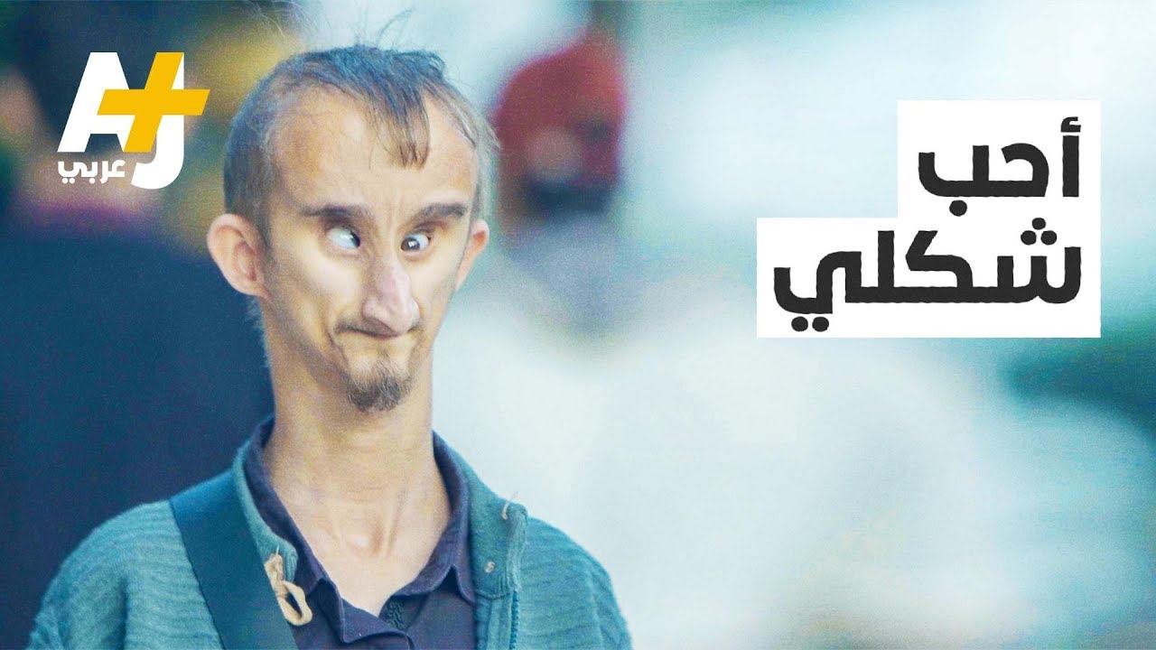 قصة إنسان | شاب جزائري شكله مختلف، وأمنيته دور في هوليود