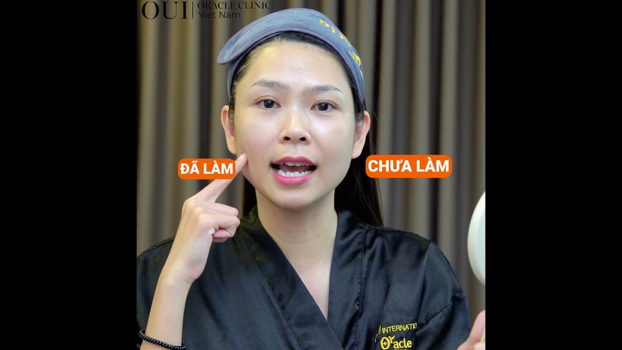 ĐIỀU G&Igrave; KHIẾN CHỊ HỒNG NHUNG LU&Ocirc;N CHỌN THERMAGE FLX TẠI ORACLE CLINCIS OF OUI SUỐT 8 NĂM QUA