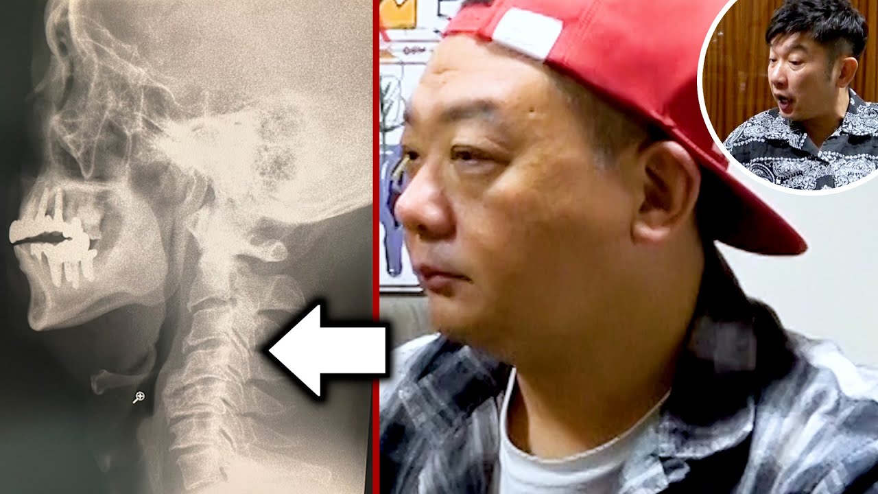 【重大報告】木下の病名がわかったので公開します。