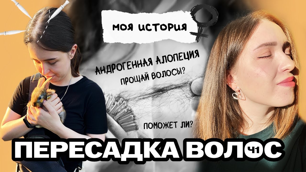Женская пересадка волос. Андрогенная алопеция. Видео ДО пересадки.