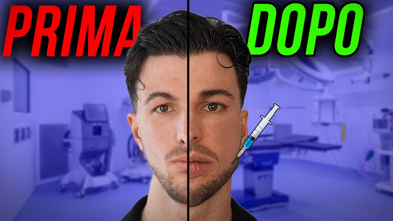 FILLER A 30 ANNI: HO FATTO UN ERRORE?