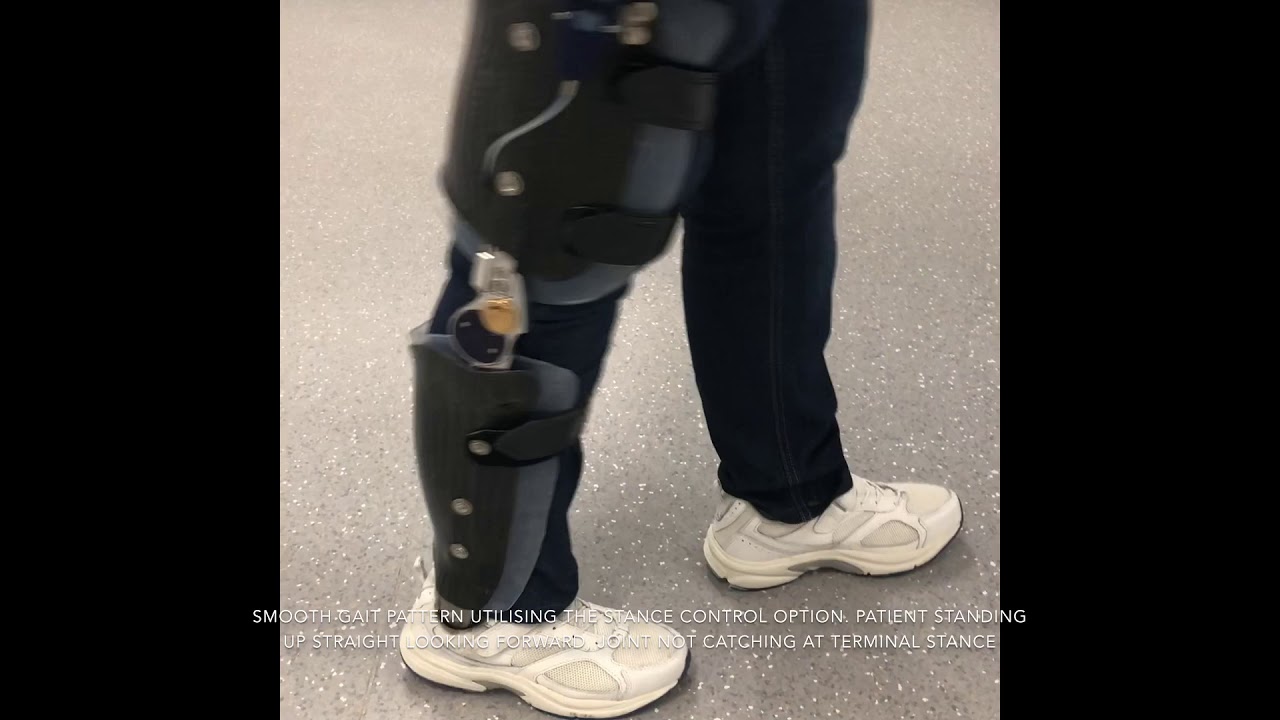 Walking with a natural gait for the first time in five years