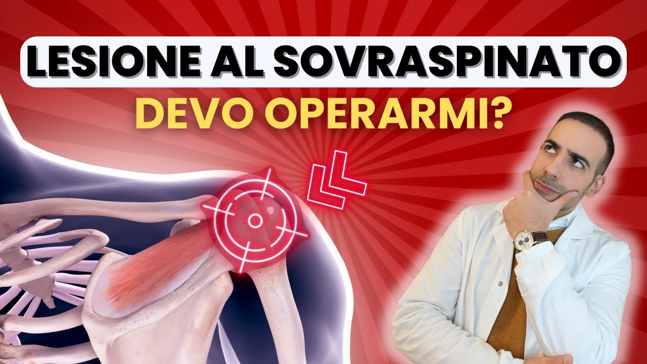 Lesione del SOVRASPINATO | Come Riconoscerla e quando Operare