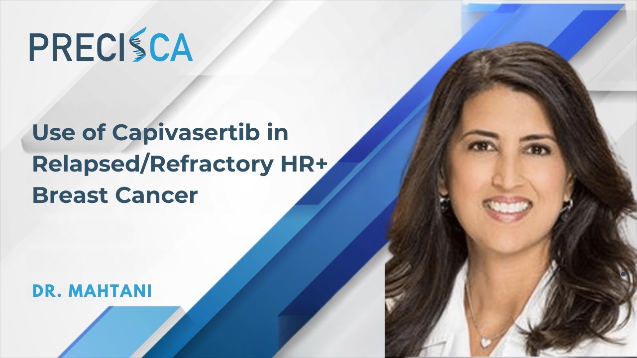 Use of Capivasertib in Relapsed/Refractory HR+ Breast Cancer