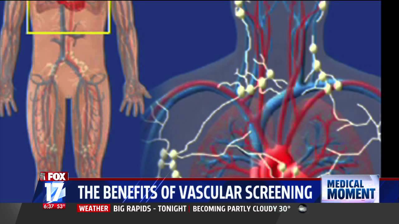 Benefits of vascular screening