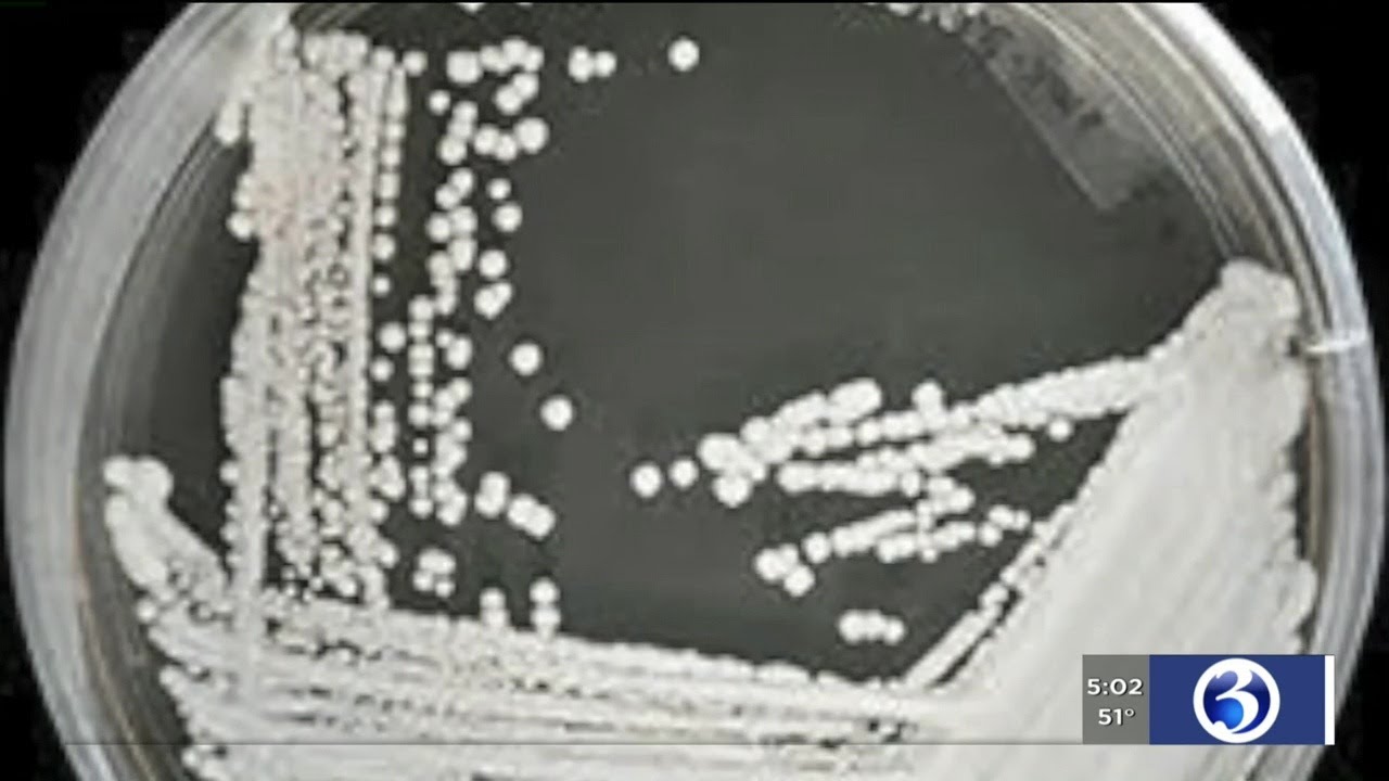 VIDEO: CDC warns about dangerous, multi-drug resistant 'superbug'