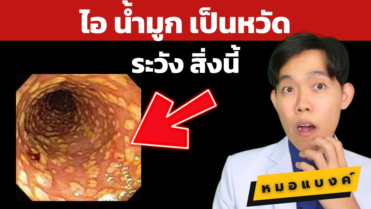 เป็นหวัด ไอ น้ำมูก เจ็บคอ ฟังด่วน !