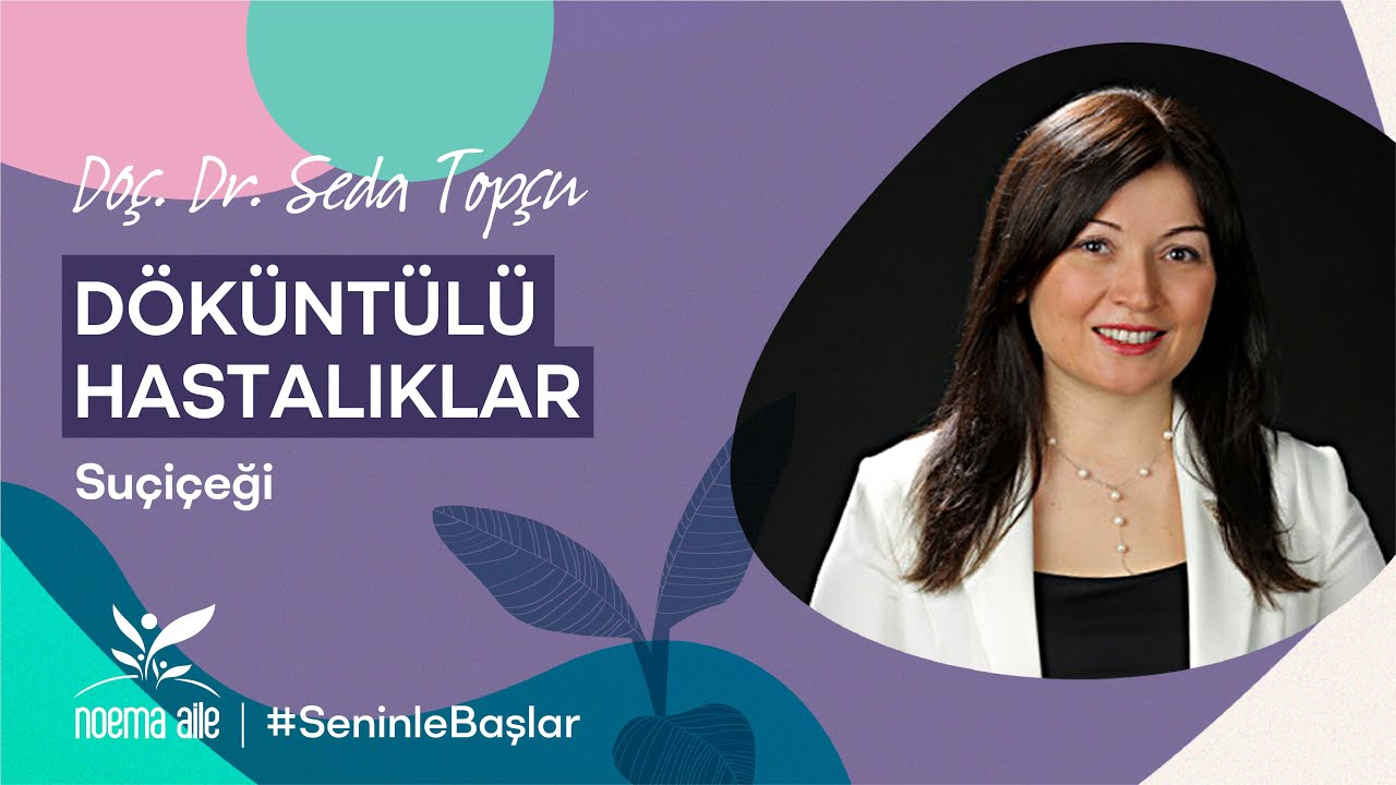Döküntülü Hastalıklar: Suçiçeği