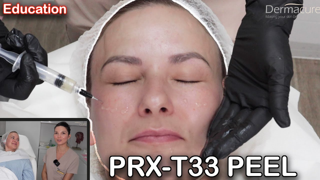 Процедура пилинга PRX T33 на всем лице и глазах, до и после (2024)