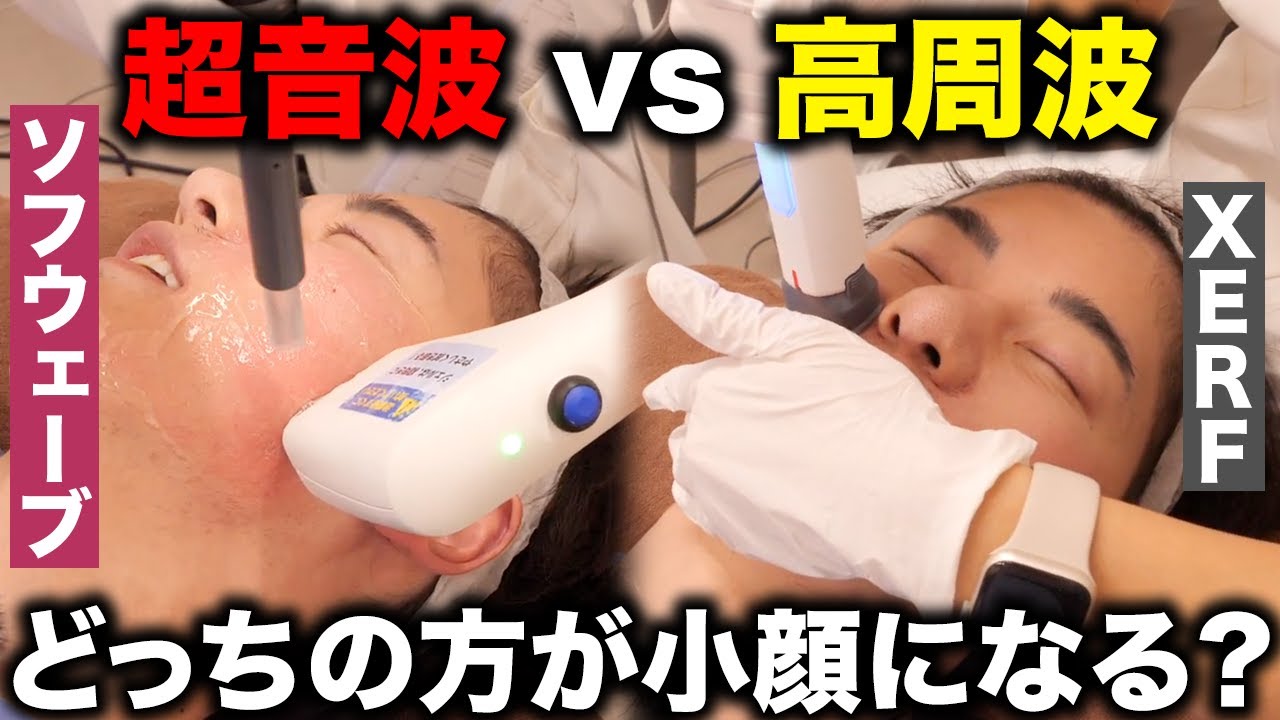 超音波vs高周波！ソフウェーブとXERF（ザーフ）を半顔施術で効果を徹底比較