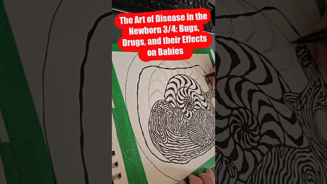 Bugs, Drugs, and Their Effects on Babies, the Art of Disease in the Newborn 3/4