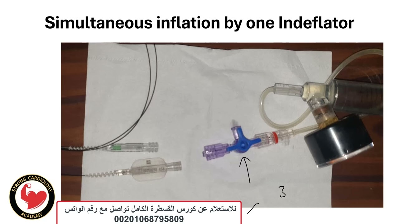 Using One Indeflator for KBI in Coronary bifurcations, Dr Alaa Nasr, 2025