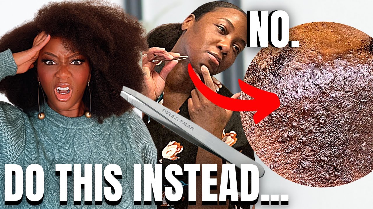Your Hair Makes Hyperpigmentation WORSE | Black & Brown Skin
