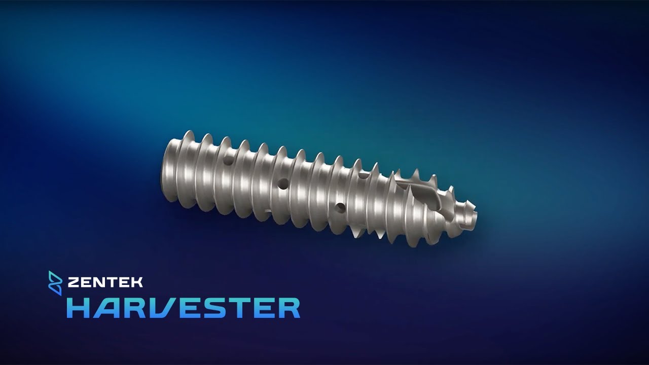 Harvester SI Fusion System | 3D-Printed Titanium Implant for SI Joint Fusion