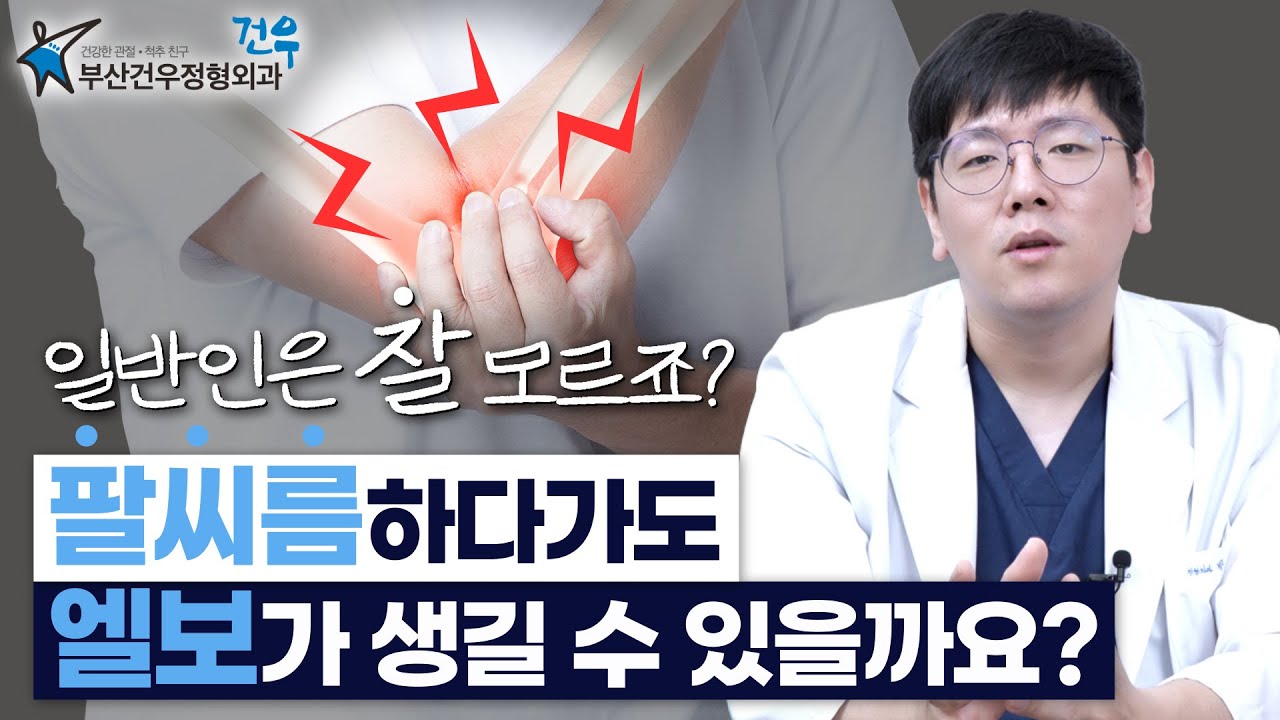 😰아니 팔씨름하다가 엘보가 왔다니까요⁉