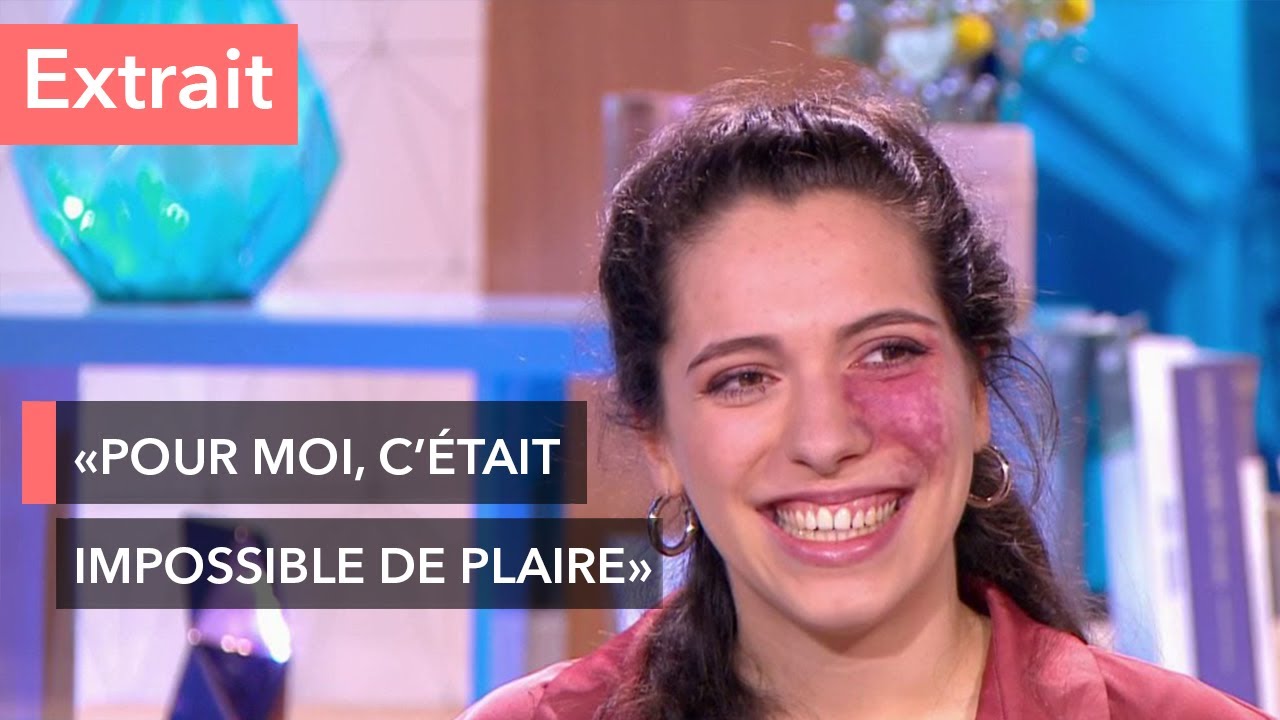 Son angiome est devenu un atout pour elle - Ça commence aujourd'hui