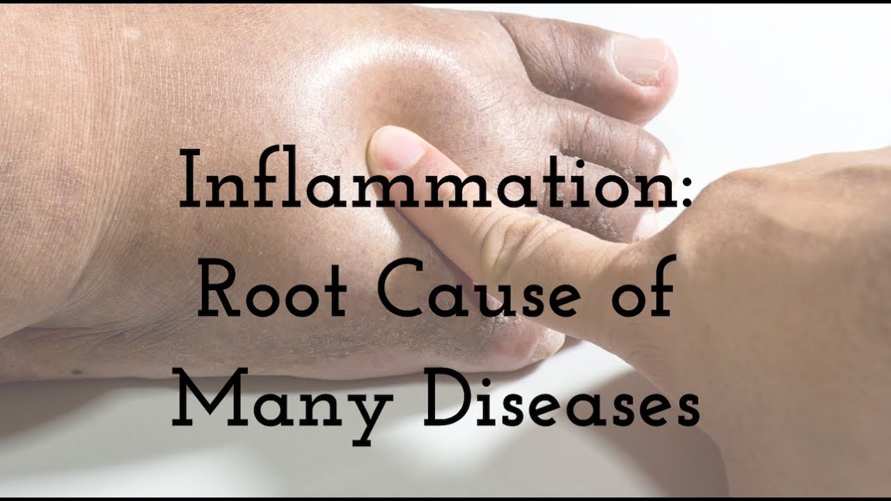 Episode 369 - Dealing with Inflammation
