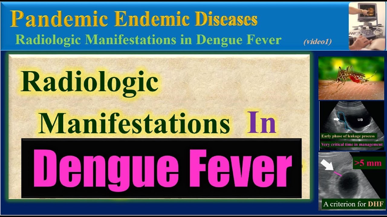 Dengue Fever , Radiologic Manifestations in Dengue Fever