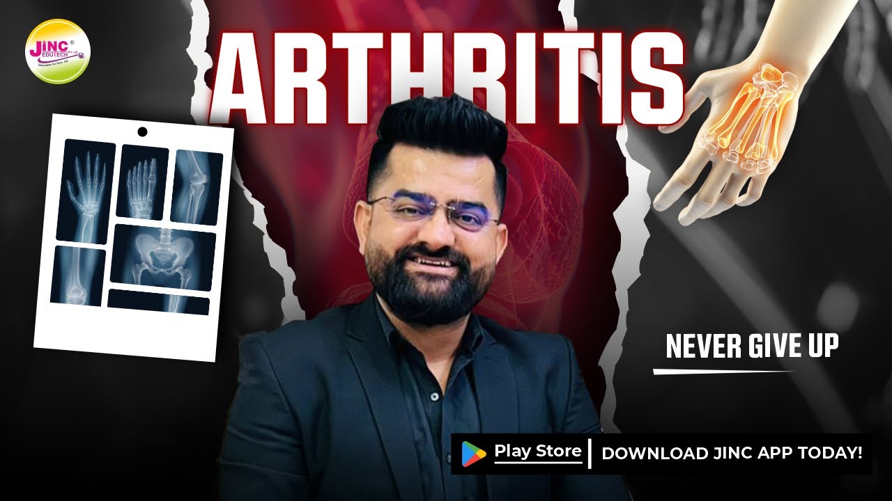 ARTHRITIS