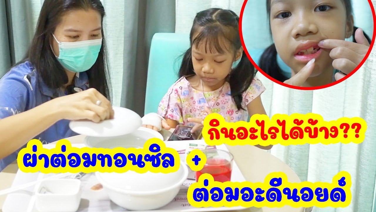 ดีไซน์ผ่าตัดต่อมทอนซิล+ต่อมอะดีนอยด์ EP.2 | อาการหลังผ่าตัด 16 ชม. ทานอะไรได้บ้าง??  ดีไซน์ทีวี