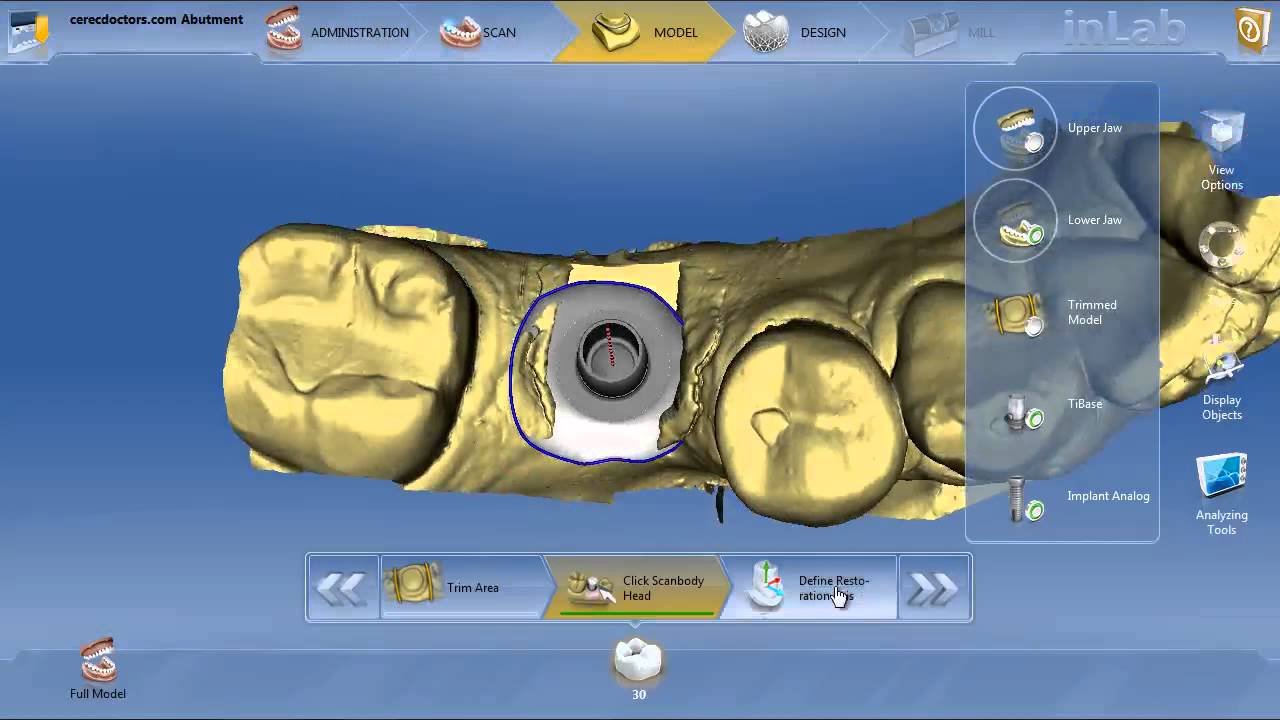 inLAB 4.0  Workflow to correct bad abutment proposal
