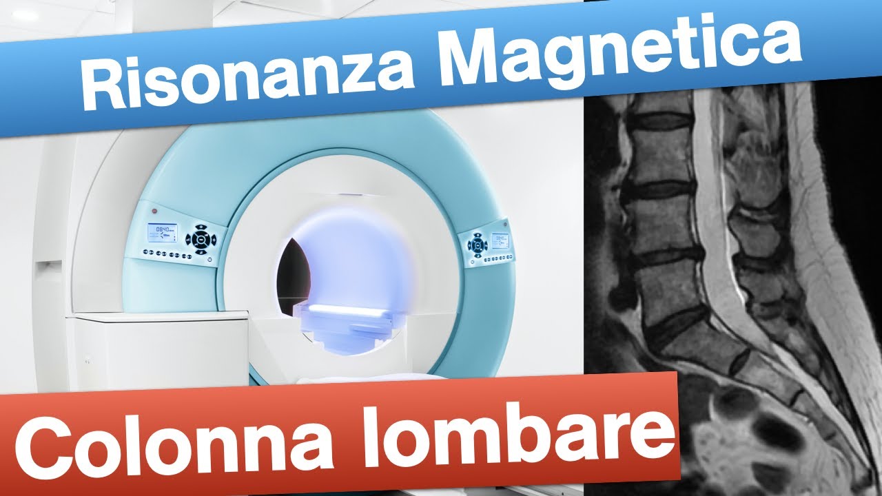 Risonanza Magnetica lombare - Quando e come eseguirla.