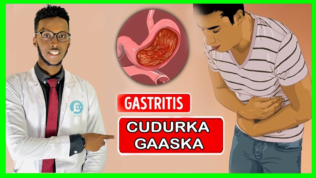 CUDURKA GAASKA IYO SIDA DABIICIGA EE LOO DAAWEEYO