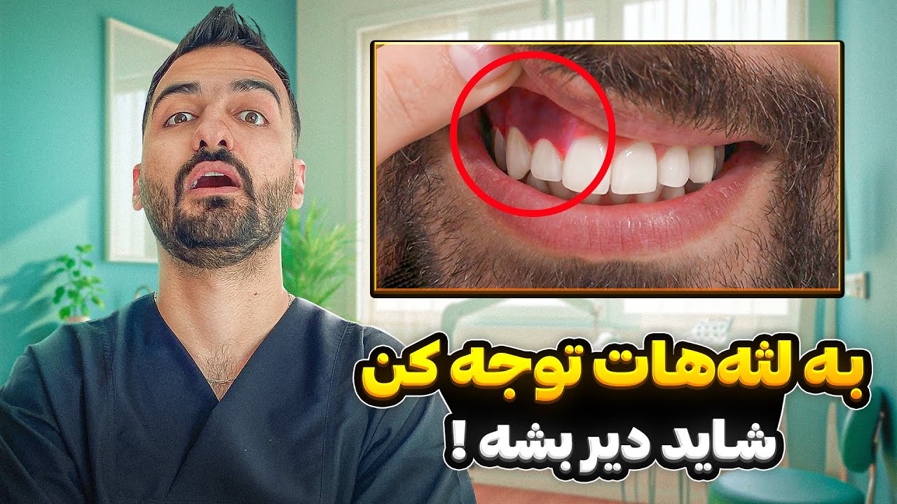 همه چیزهایی که باید درباره تحلیل لثه بدونید