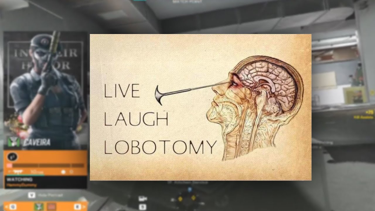 when the lobotomy hits r6 siege.