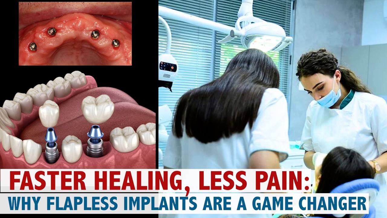 Faster Healing, Less Pain: Why Flapless Implants Are a Game Changer