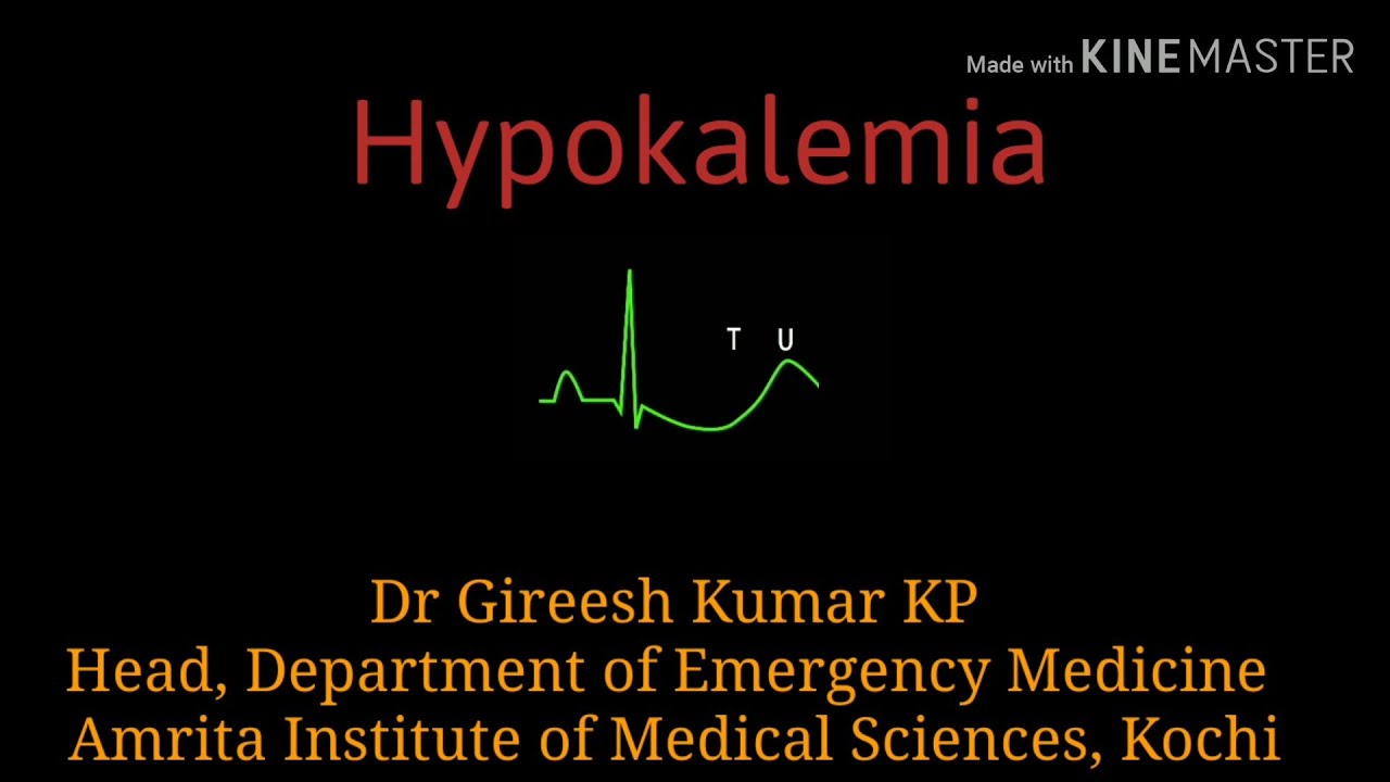 Hypokalemia, by Dr Gireesh Kumar KP