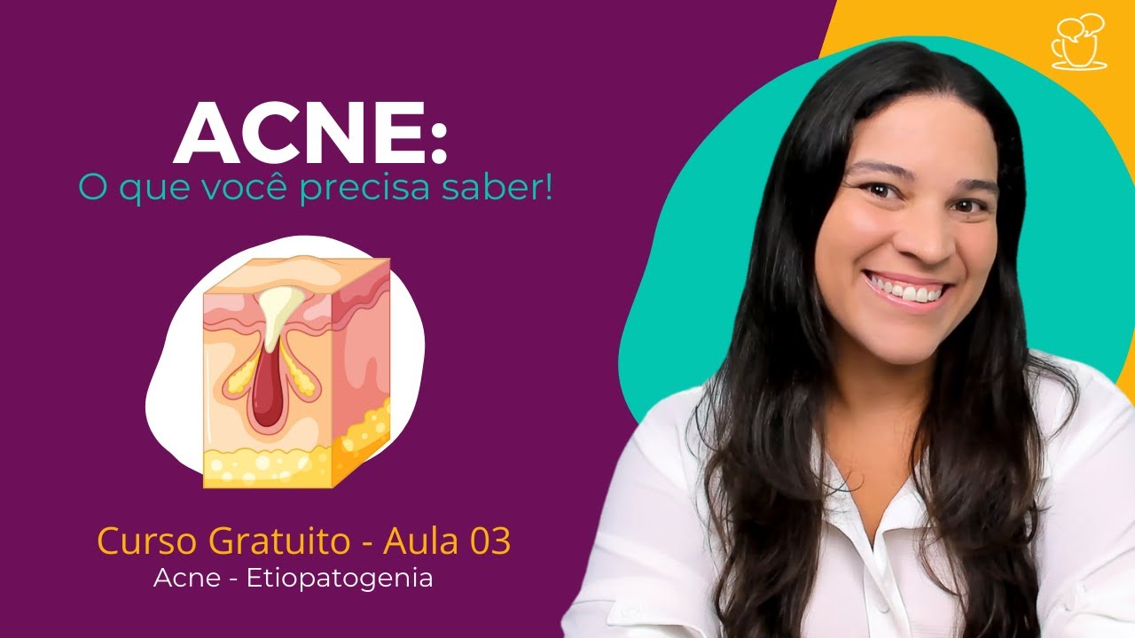 Como a acne é formada? [Etiopatogenia - Aula 03] Curso de Estética Gratuito e Online!
