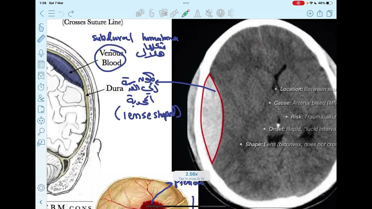 Anatomy 7 p1_Marah Mhesen