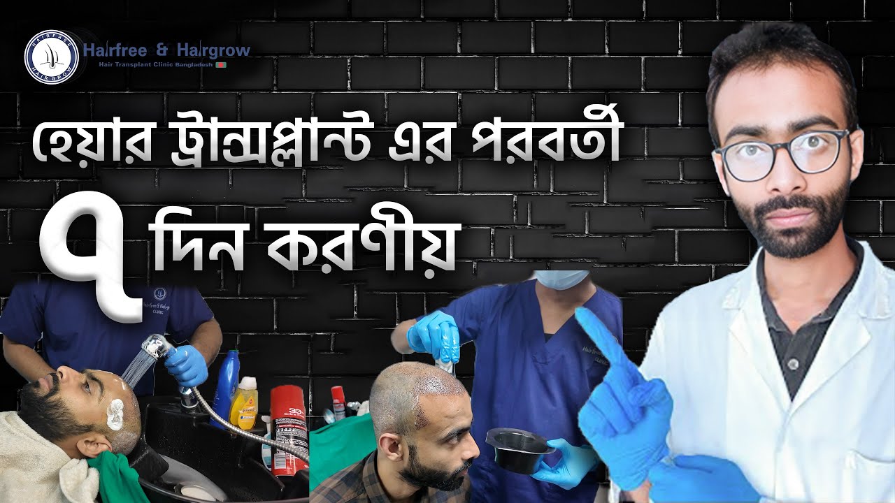 Netherlands Famous Scientist's @sabbir_scientist First Head Wash After Hair Transplant Experience