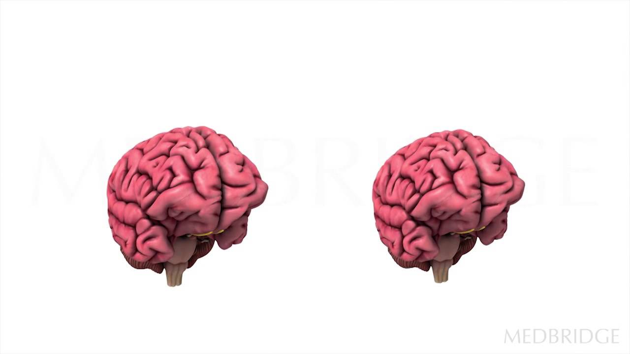 Dementia- Using Assistive Technology Video : Carrie Ciro | MedBridge