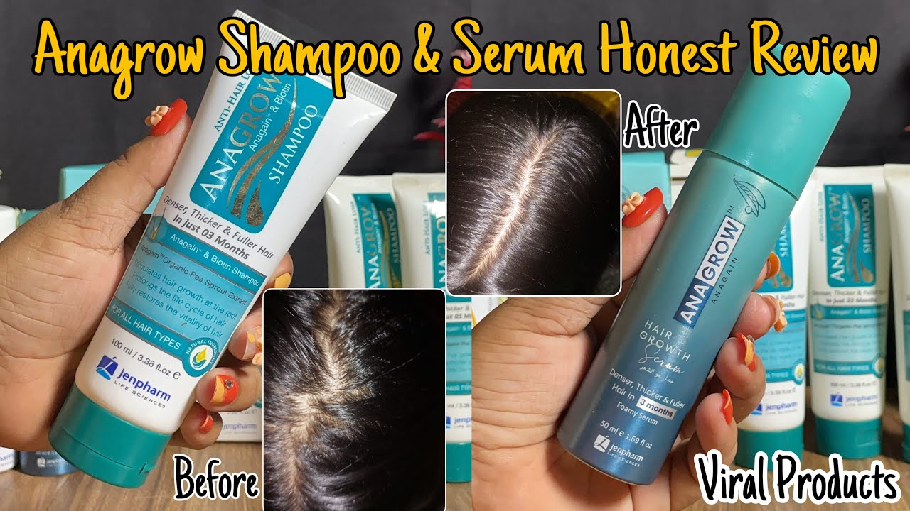 Anagrow Shampoo and Serum Honest Review | jenpharm  Anagrow Hair Growth Bundle | worth it? 