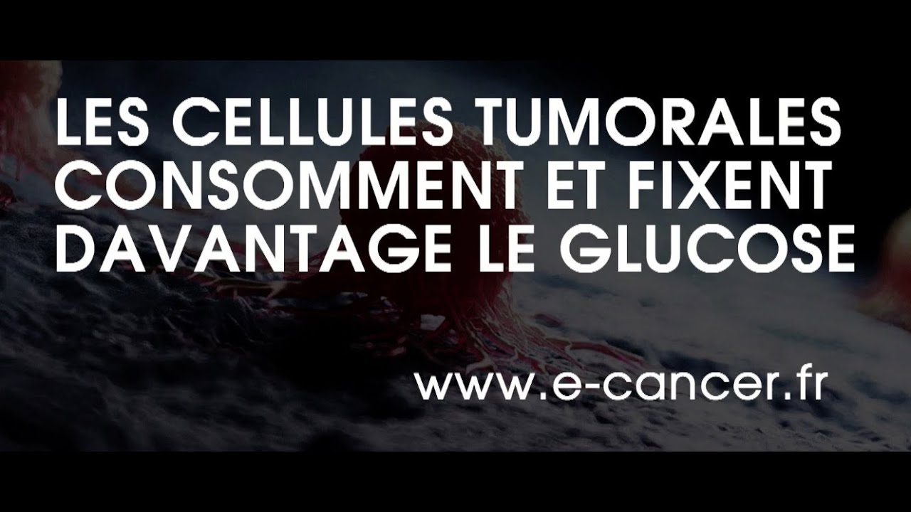 SUCRE ET CANCER : LA PREUVE AVEC LE TEP SCANNER