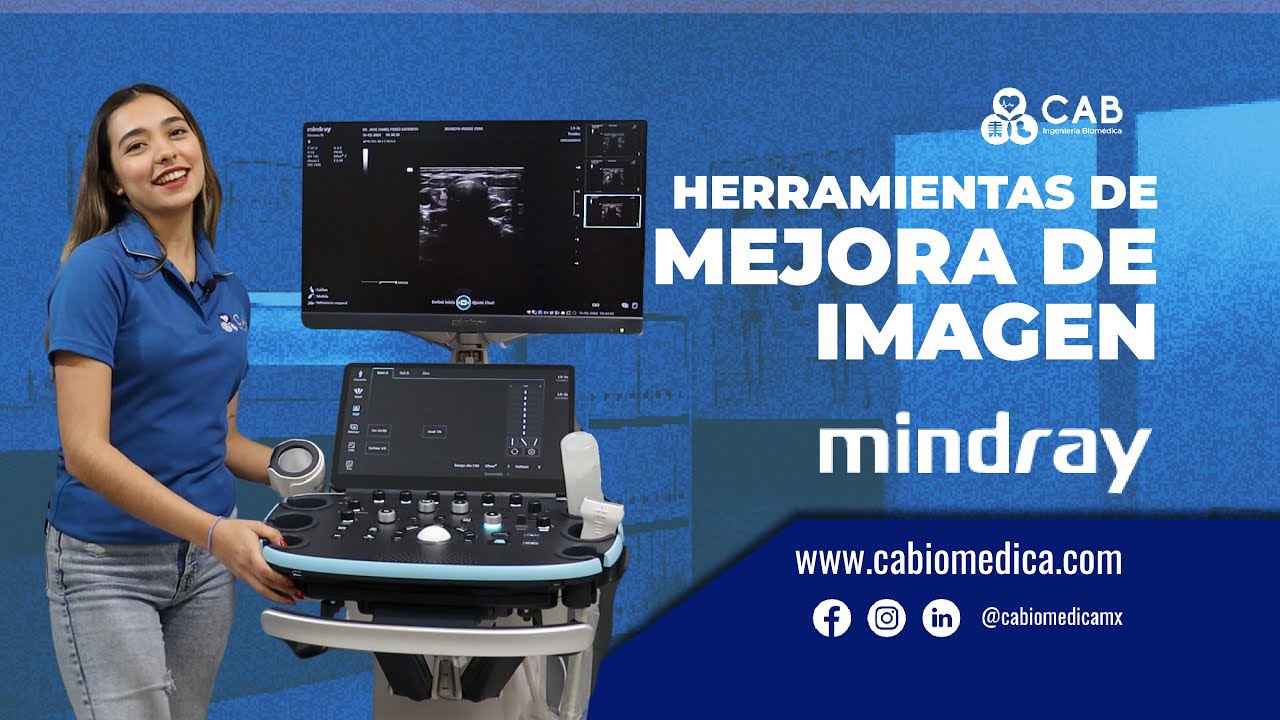Resona i9 | Herramientas de Mejora de Imagen