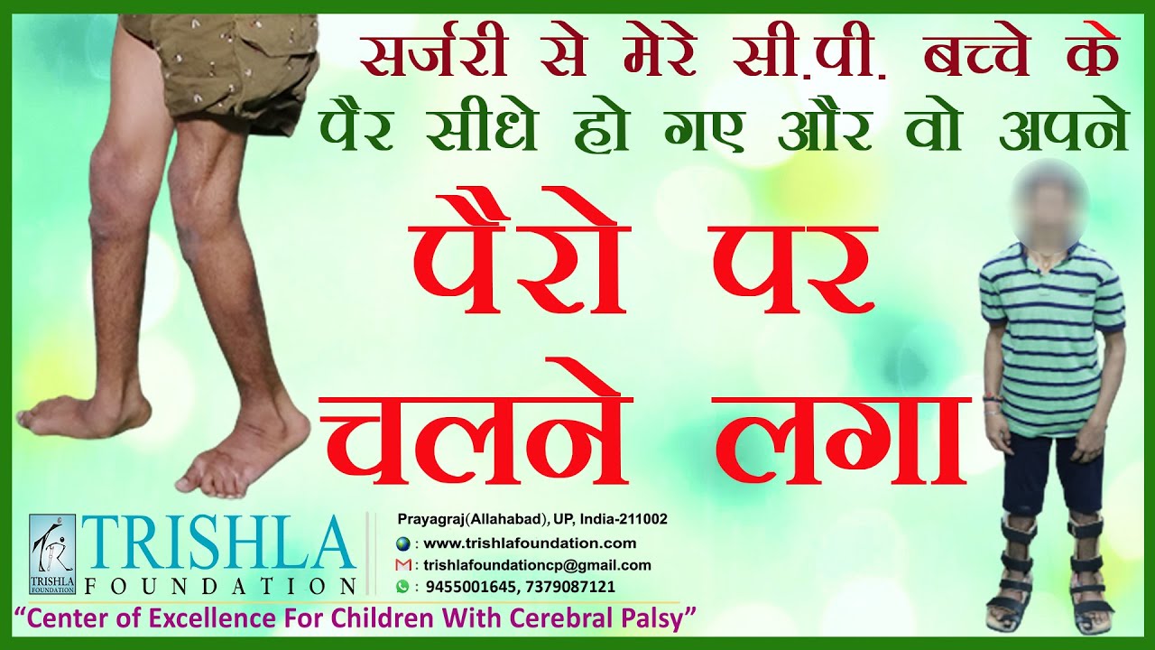 CP Child Starts Walking After 15 Years of Age - A Remarkable Achievement in the Eyes of Parents