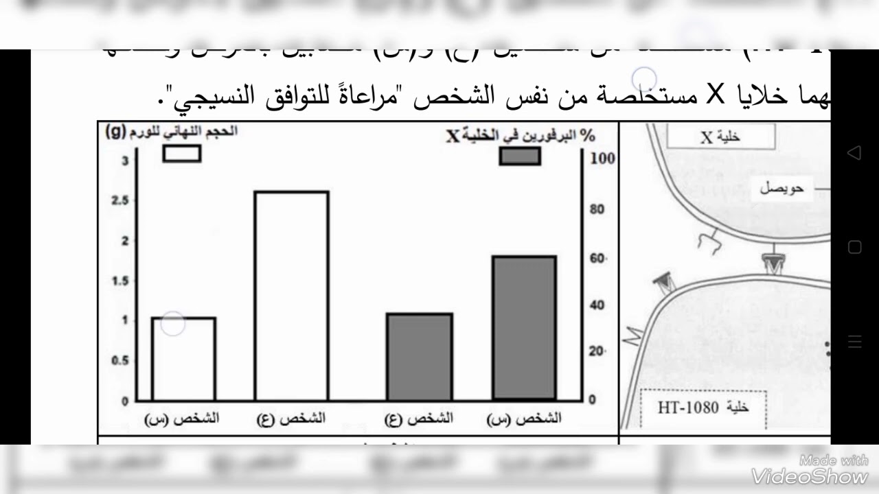 تحضير ياك 2023 تمرين حول العجز المناعي وعلاجة لمرض الساركوما الليفية(سرطان الانسجة الضامة)
