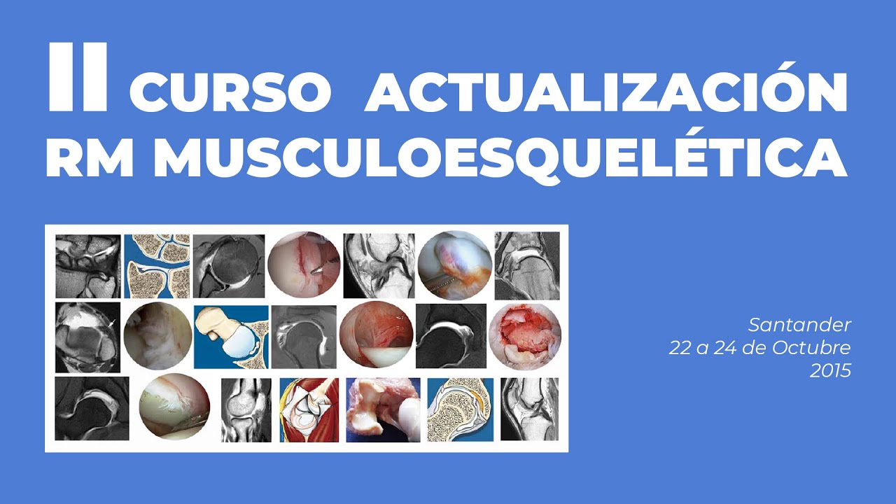 #3 Extremidad superior, Hombro. Anatomía. [II Curso actualización RM Musculoesquelética 2015]