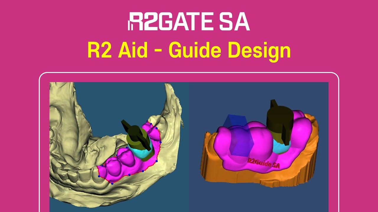 R2GATE SA Tutorial Series | Step 7: R2 Guide design! 👉 Read description first🔥