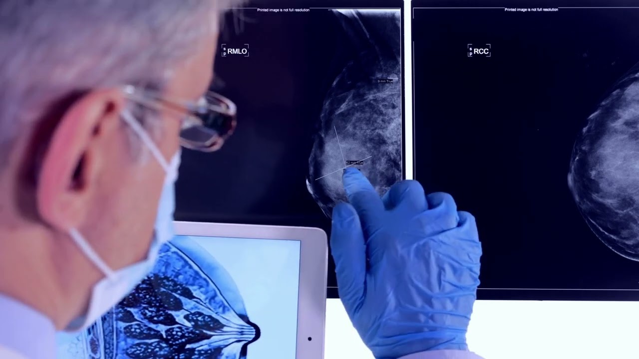 Get to Know Breast Care Center Miami